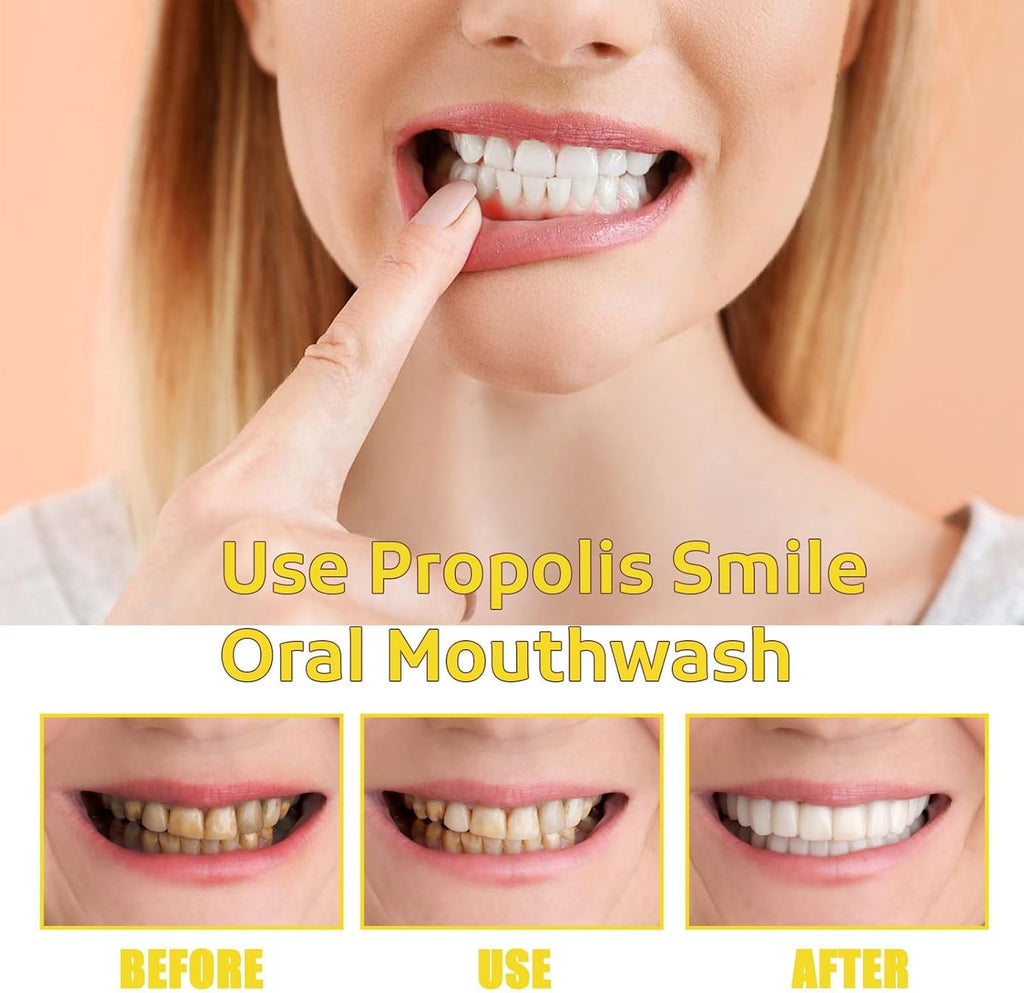 Propolis Oral Cleaning Mousse - Freshens Breath, Removes Surface Stains, Natural Daily Oral Care Mousse(2pcs)
