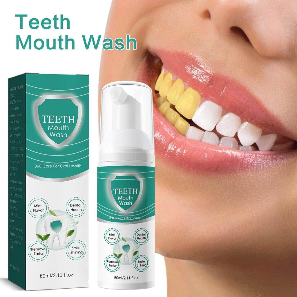 2PCS Foam Toothpaste,Stain Removal Toothpaste, Ultra-fine Mousse Foam, Deeply Cleans (2)