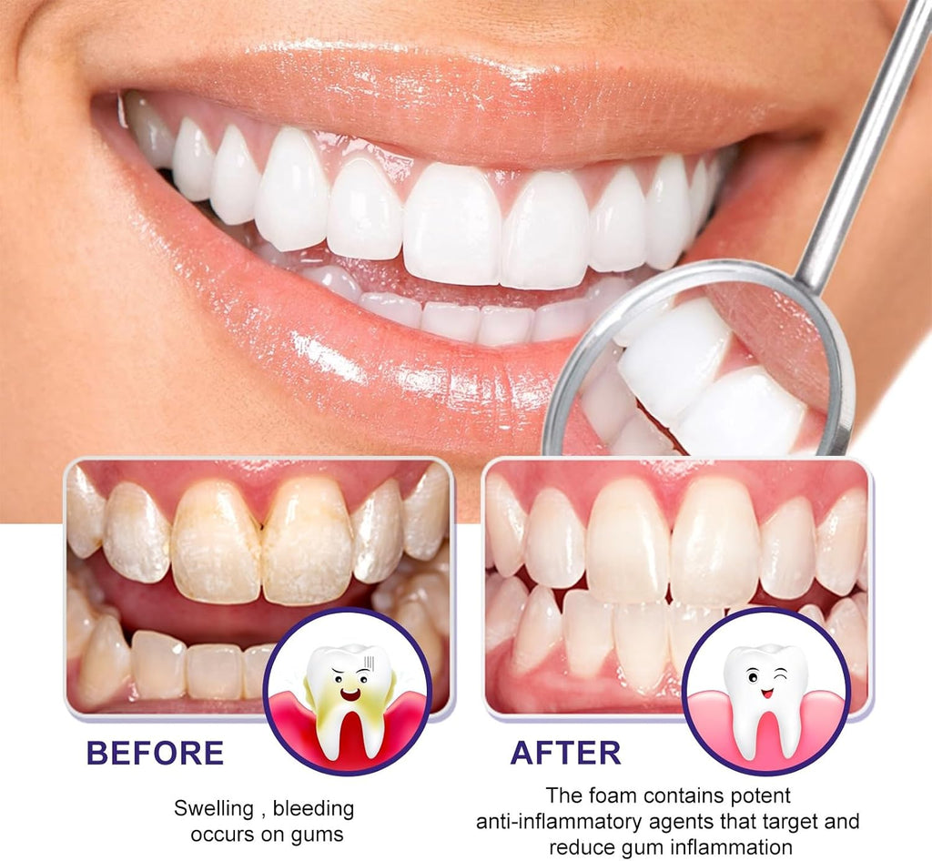Gum Care Foam Mousse with Arginine & Licorice Extract - Oral Hygiene, Teeth Whitening & Comfort Support(2pcs)