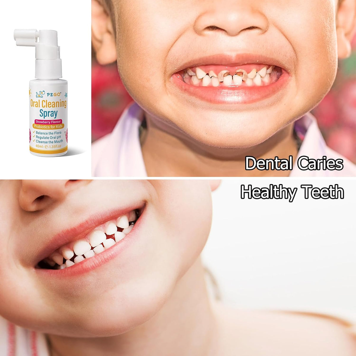 Kids Oral Spray, Toddler Toothpaste Helper for Cavity Prevention and Fresh Breath, Children Anticavity with Fluoride Free for Newborn to Preschoolers, Kid's Mouth Spray (2)