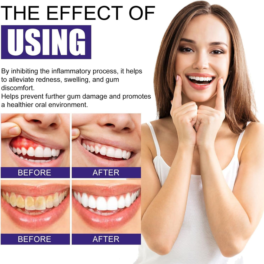 Gum Care Foam Mousse with Arginine & Licorice Extract - Oral Hygiene, Teeth Whitening & Comfort Support(2pcs)