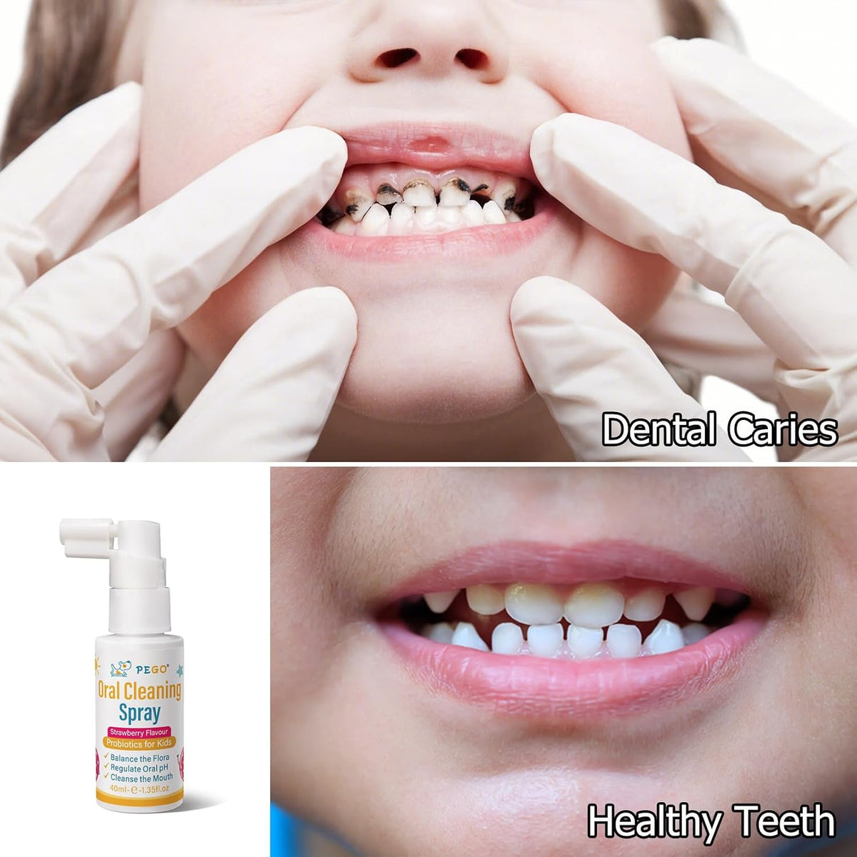 Kids Oral Spray, Toddler Toothpaste Helper for Cavity Prevention and Fresh Breath, Children Anticavity with Fluoride Free for Newborn to Preschoolers, Kid's Mouth Spray (2)