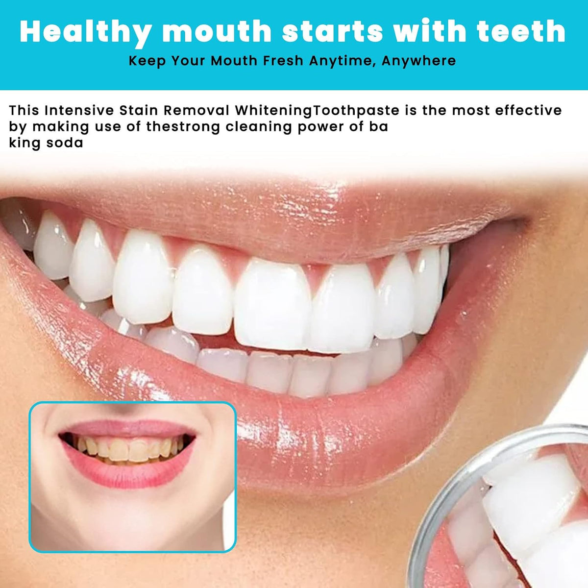 Eelhoe Mouthwash Teeth Whitening Kit Mousse Foam Toothpaste，Oral Care-Toothpaste Replacement，Calculus Removal, Healing Mouth Ulcers, Eliminating Bad Breath, Prevents and Treats Cavities (2pcs)
