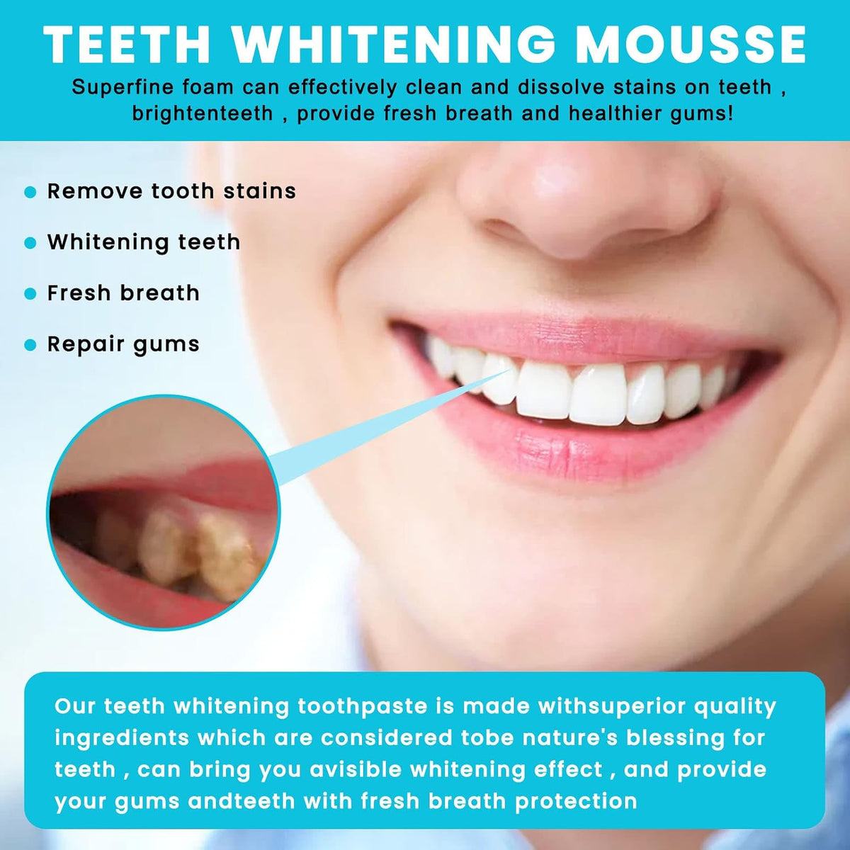 Eelhoe Mouthwash Teeth Whitening Kit Mousse Foam Toothpaste，Oral Care-Toothpaste Replacement，Calculus Removal, Healing Mouth Ulcers, Eliminating Bad Breath, Prevents and Treats Cavities (2pcs)