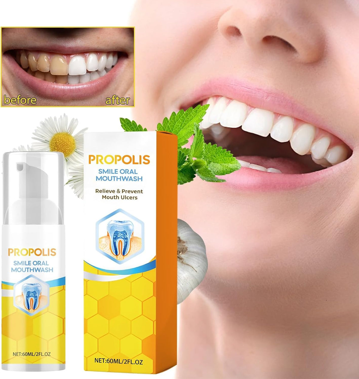 Propolis Oral Cleaning Mousse - Freshens Breath, Removes Surface Stains, Natural Daily Oral Care Mousse(2pcs)